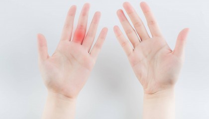 医学基础知识重点归纳：腱鞘炎症状及治愈良方！早看早知道